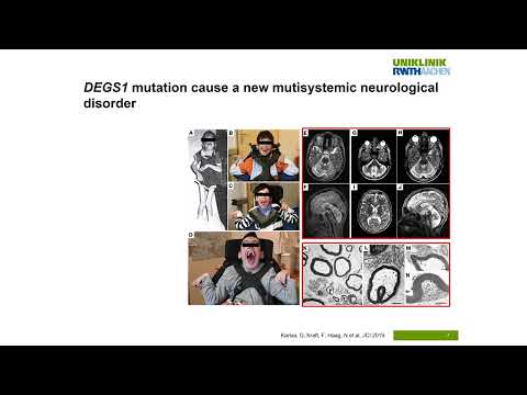The power of whole exome sequencing to unravel the cause of rare disease